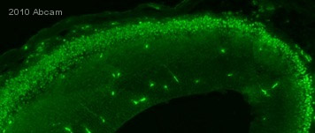 ab18465-Anti-Ctip2 antibody 25B6 - ChIP Grade-抗体/抗原