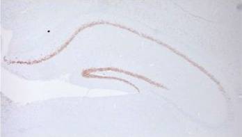 ab18465-Anti-Ctip2 antibody 25B6 - ChIP Grade-抗体/抗原