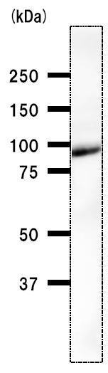 ab51502-Anti-SATB2 antibody SATBA4B10 （ab51502）-抗体/抗原