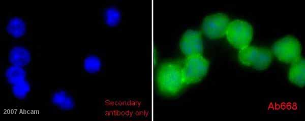 ab668-Anti-Cytokeratin 18 C-04 antibody （ab668）抗细胞角蛋白18抗体-抗体/抗原