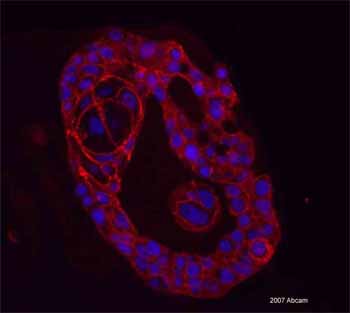 ab15148-Anti-E Cadherin antibody （ab15148）抗E钙黏蛋白抗体-抗体/抗原
