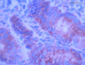ab15148-Anti-E Cadherin antibody （ab15148）抗E钙黏蛋白抗体-抗体/抗原