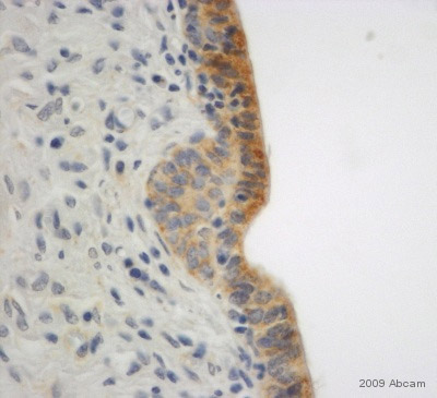 ab15148-Anti-E Cadherin antibody （ab15148）抗E钙黏蛋白抗体-抗体/抗原