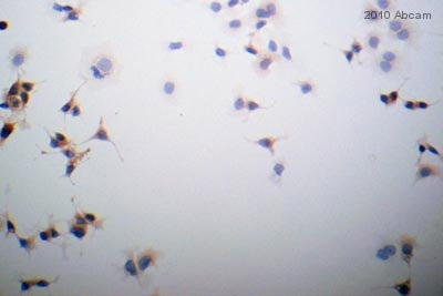ab15148-Anti-E Cadherin antibody （ab15148）抗E钙黏蛋白抗体-抗体/抗原