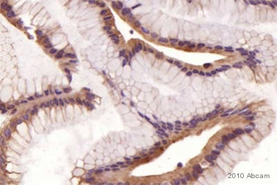ab15148-Anti-E Cadherin antibody （ab15148）抗E钙黏蛋白抗体-抗体/抗原