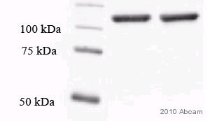 ab15148-Anti-E Cadherin antibody （ab15148）抗E钙黏蛋白抗体-抗体/抗原