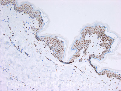 ab9053-Anti-Histone H4 （tri methyl K20） antibody - ChIP Grade （ab9053）-抗体/抗原