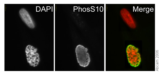 ab14955-Anti-Histone H3 （phospho S10） mAbcam 14955 antibody - ChIP Grade （ab14955）-抗体/抗原