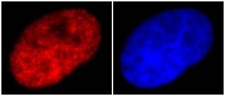 ab12179-Anti-Histone H3 （acetyl K9） AH3-120 antibody - ChIP Grade （ab12179）-抗体/抗原