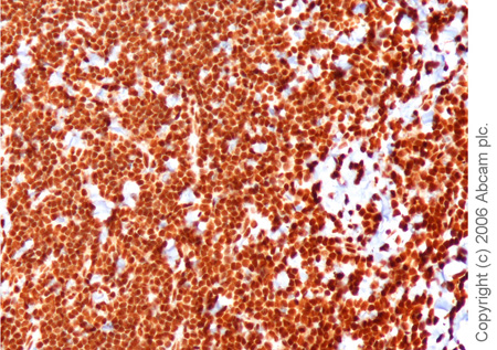 ab9050-Anti-Histone H3 （tri methyl K36） antibody - ChIP Grade （ab9050）-抗体/抗原