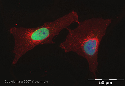 ab9050-Anti-Histone H3 （tri methyl K36） antibody - ChIP Grade （ab9050）-抗体/抗原