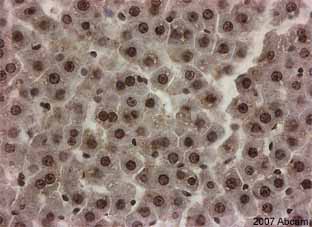 ab9050-Anti-Histone H3 （tri methyl K36） antibody - ChIP Grade （ab9050）-抗体/抗原