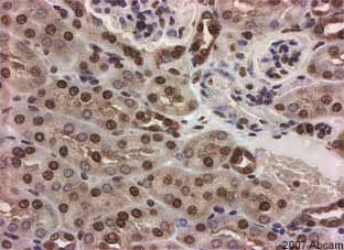 ab9050-Anti-Histone H3 （tri methyl K36） antibody - ChIP Grade （ab9050）-抗体/抗原
