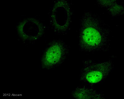 ab9050-Anti-Histone H3 （tri methyl K36） antibody - ChIP Grade （ab9050）-抗体/抗原