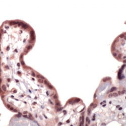 ab31163-Anti-Nrf2 antibody （ab31163）抗核转录因子2抗体-抗体/抗原