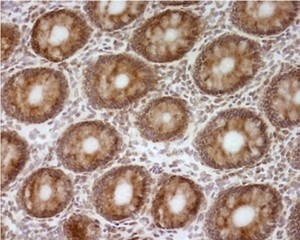 ab110276-Anti-ATP5O 4C11C10D12 antibody （ab110276）抗ATP5O 4C-抗体/抗原