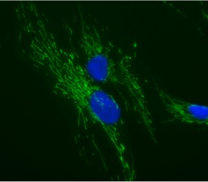 ab110276-Anti-ATP5O 4C11C10D12 antibody （ab110276）抗ATP5O 4C-抗体/抗原