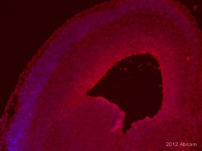ab78545-Anti-PAX6 antibody AD2.38 （ab78545）抗转录因子Pax6抗体-抗体/抗原