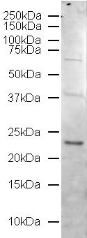 ab18211-Anti-Rab5 antibody - Early Endosome Marker （ab18211）Anti-Rab5早期核内体标记-抗体/抗原