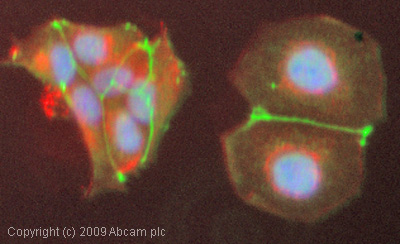（ab59720-Anti-ZO1 tight junction protein antibody （ab59720）抗ZO1紧密连接蛋白抗体-抗体/抗原
