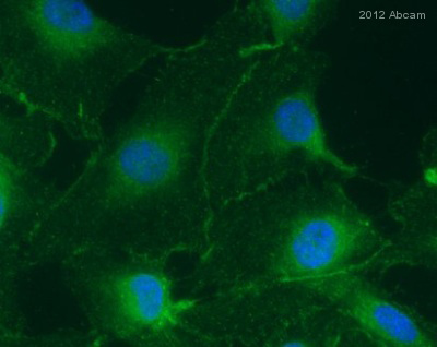 （ab59720-Anti-ZO1 tight junction protein antibody （ab59720）抗ZO1紧密连接蛋白抗体-抗体/抗原