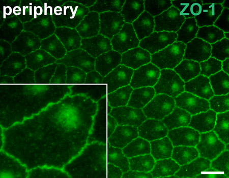 （ab59720-Anti-ZO1 tight junction protein antibody （ab59720）抗ZO1紧密连接蛋白抗体-抗体/抗原