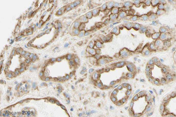 ab21679-Anti-Clathrin heavy chain 抗体 （ab21679）-抗体/抗原