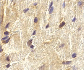 ab21288-Anti-ECSIT antibody （ab21288）抗ECSIT抗体-抗体/抗原
