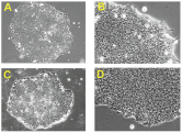 PGroF-500 PSGro-case-StemRD  PSGro 人iPS细胞和胚胎干细胞无血清培养基