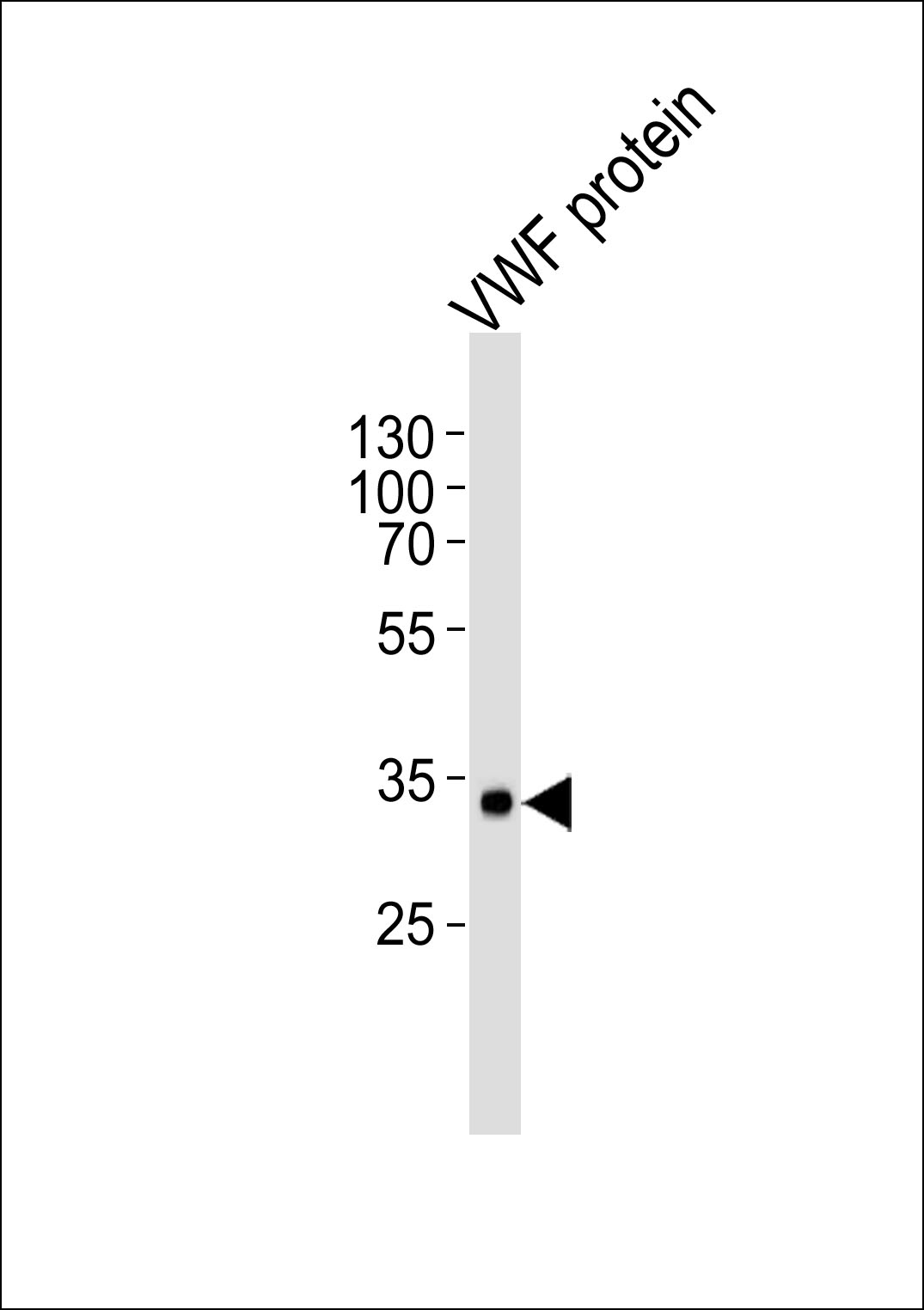 Mouse anti-VWF Monoclonal Antibody(907CT12.1.9)