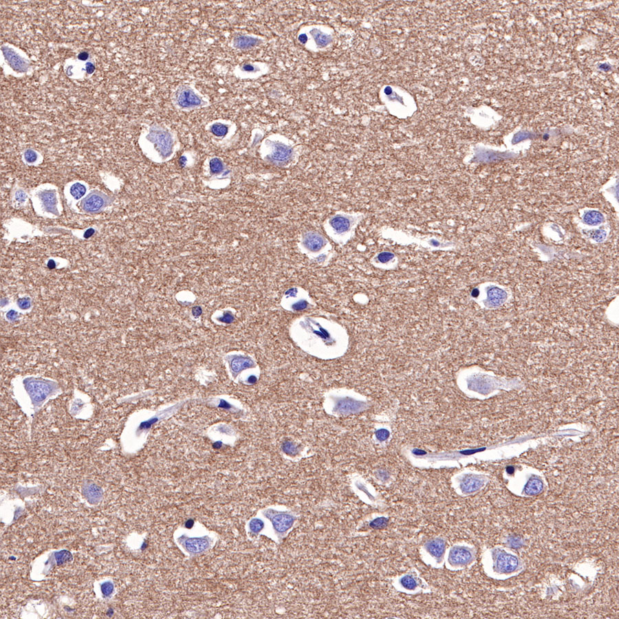 Rabbit anti-CD47 Recombinant Monoclonal Antibody(295-33)