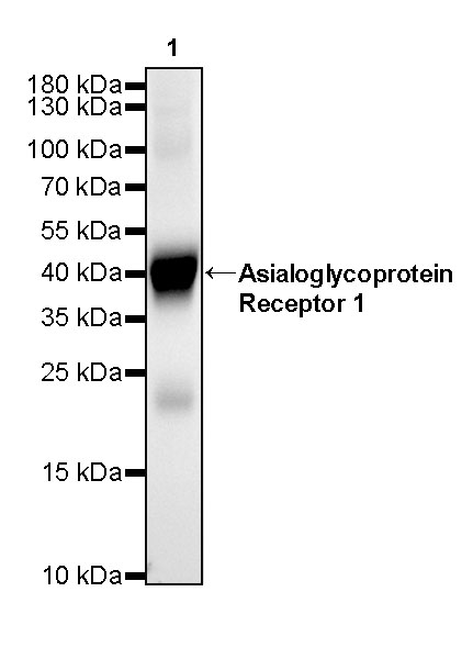 Rabbit anti-Asialoglycoprotein Receptor 1 Recombinant Monoclonal Antibody(292-48)