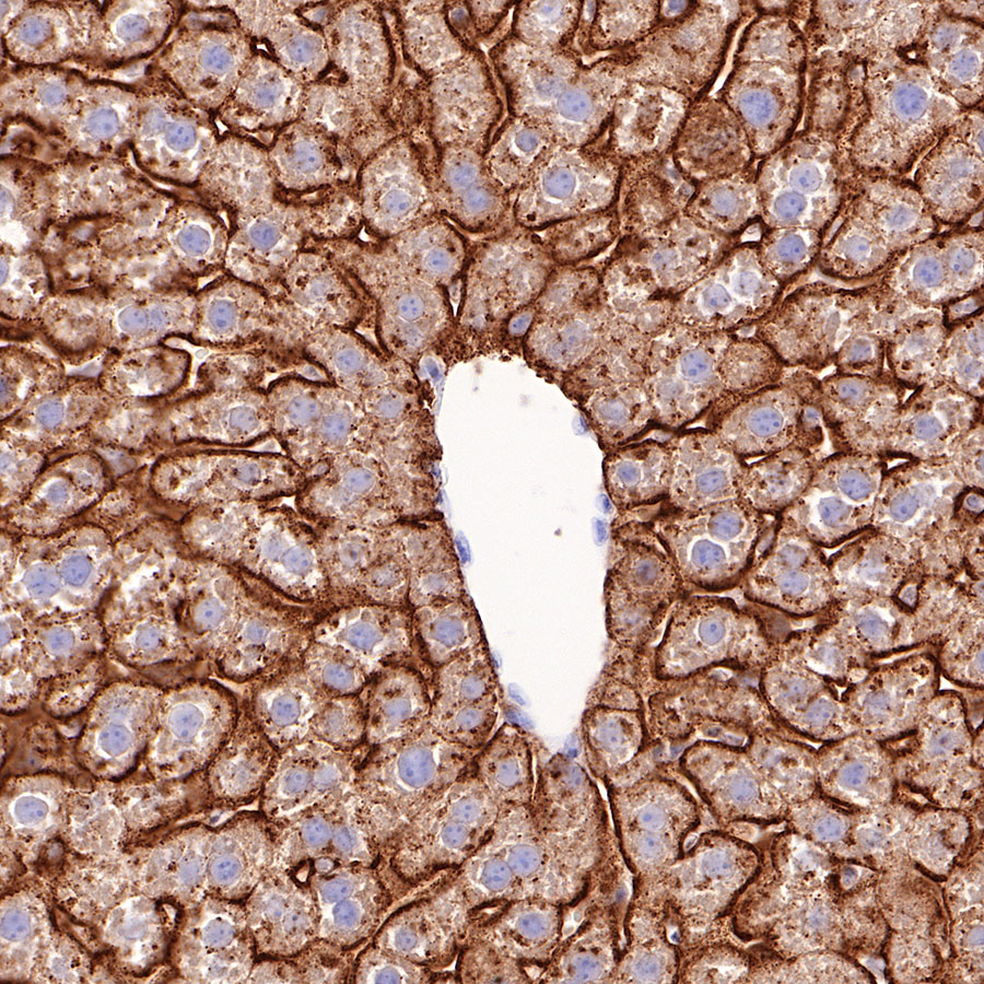 Rabbit anti-Asialoglycoprotein Receptor 1 Recombinant Monoclonal Antibody(292-48)