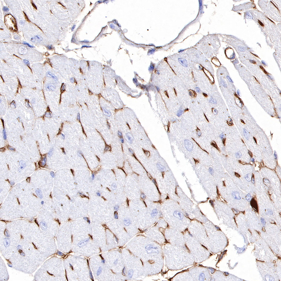 Rabbit anti-CD38 Recombinant Monoclonal Antibody(290-45)