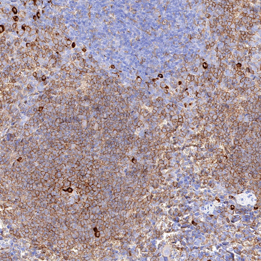 Rabbit anti-CD38 Recombinant Monoclonal Antibody(290-45)
