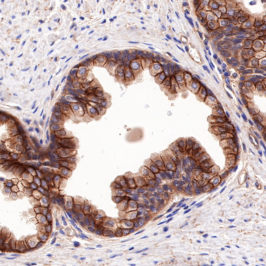 Rabbit anti-CD155 Recombinant Monoclonal Antibody(289-68)