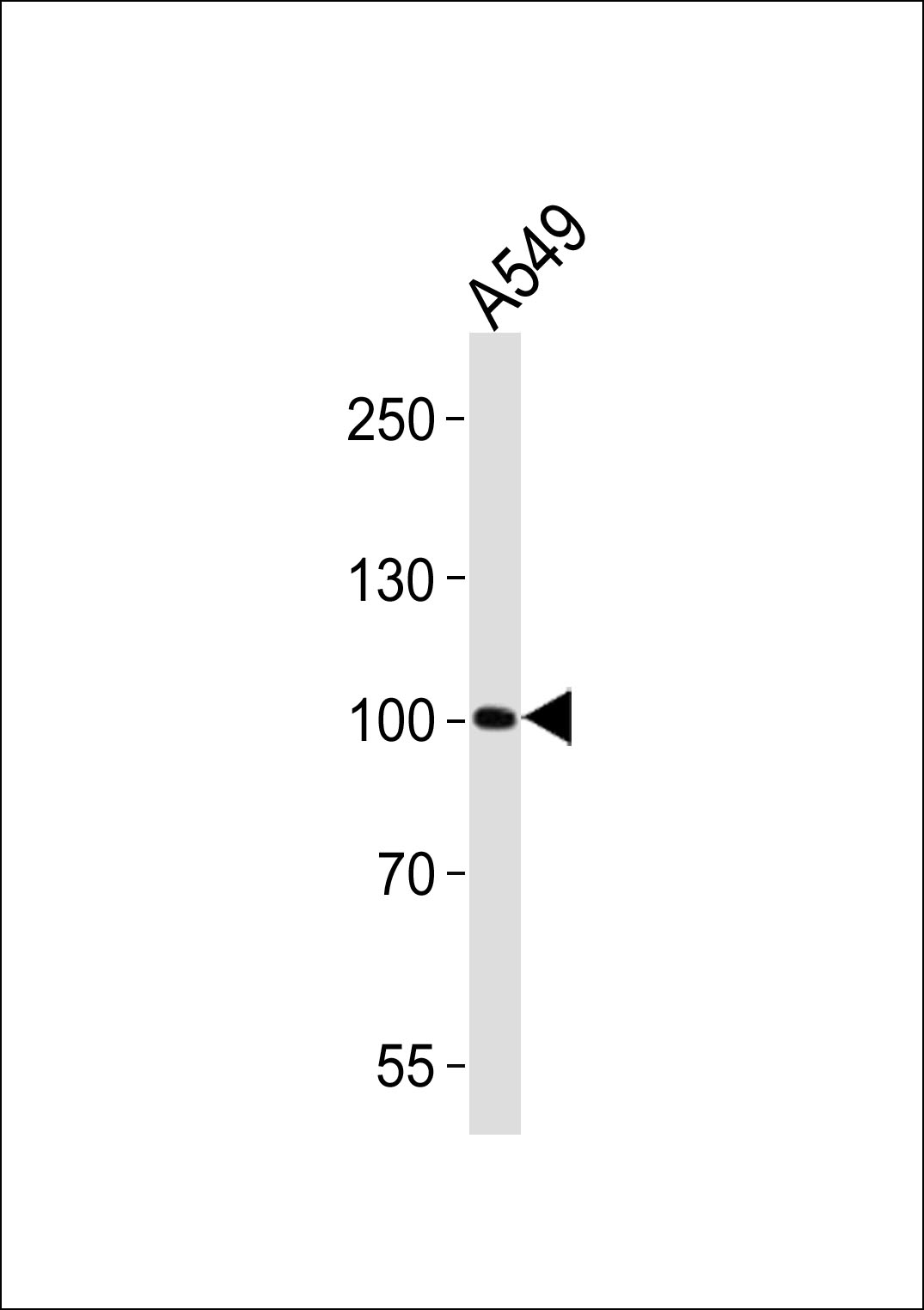 Rabbit anti-ZNF287 Polyclonal Antibody(N-term)