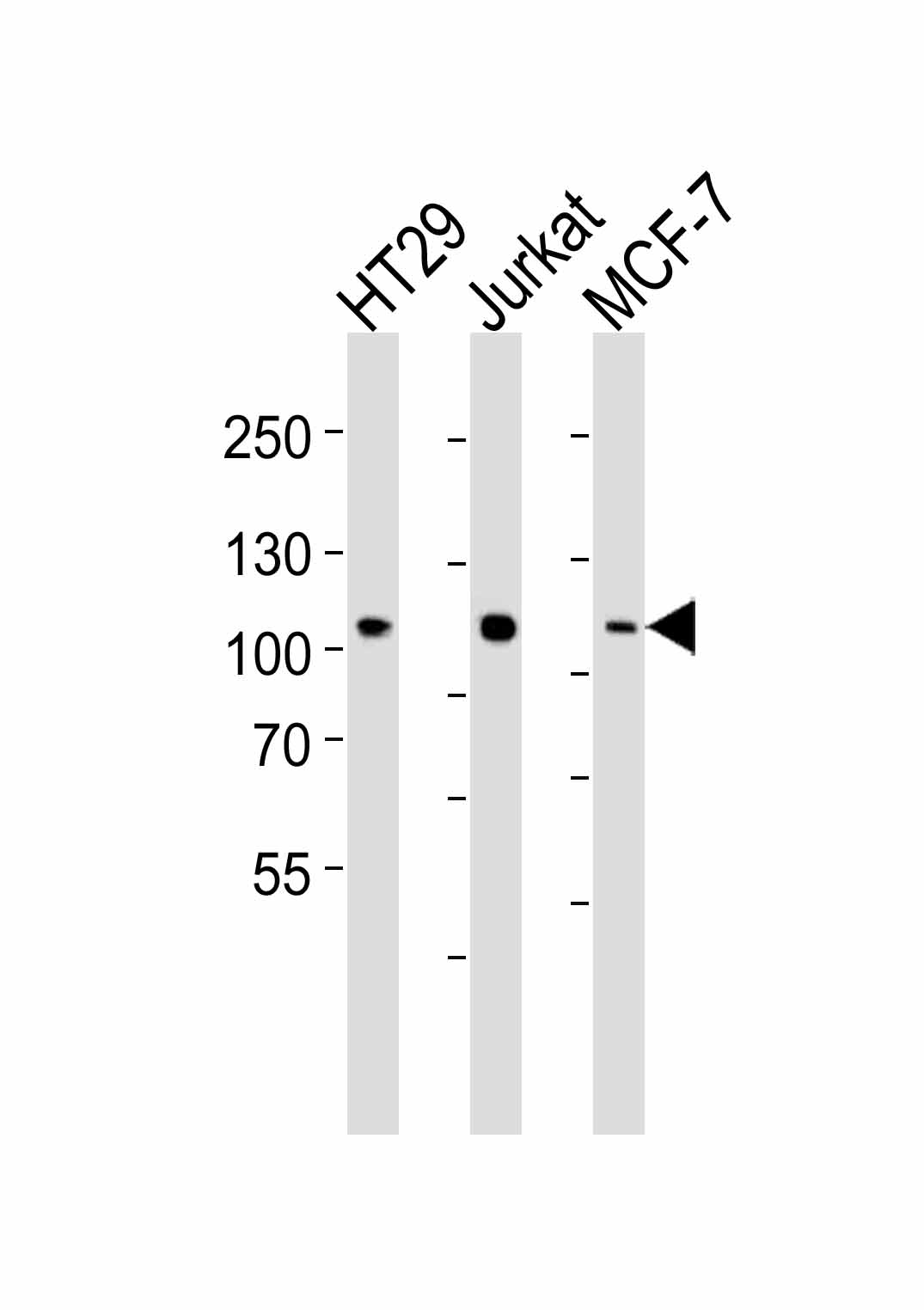Mouse anti-P100 Monoclonal Antibody(19AT953.286.93)