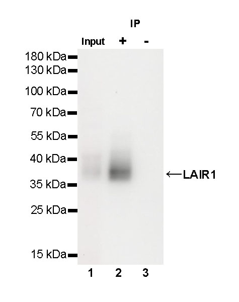 Rabbit anti-LAIR1 Recombinant Monoclonal Antibody(S-285-2)