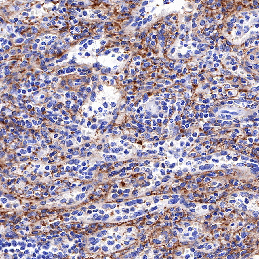 Rabbit anti-CD226 Recombinant Monoclonal Antibody(284-30)