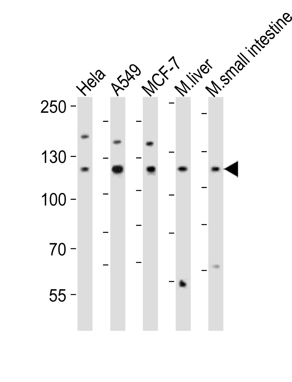 Rabbit anti-ZNF281 Polyclonal Antibody(Center)