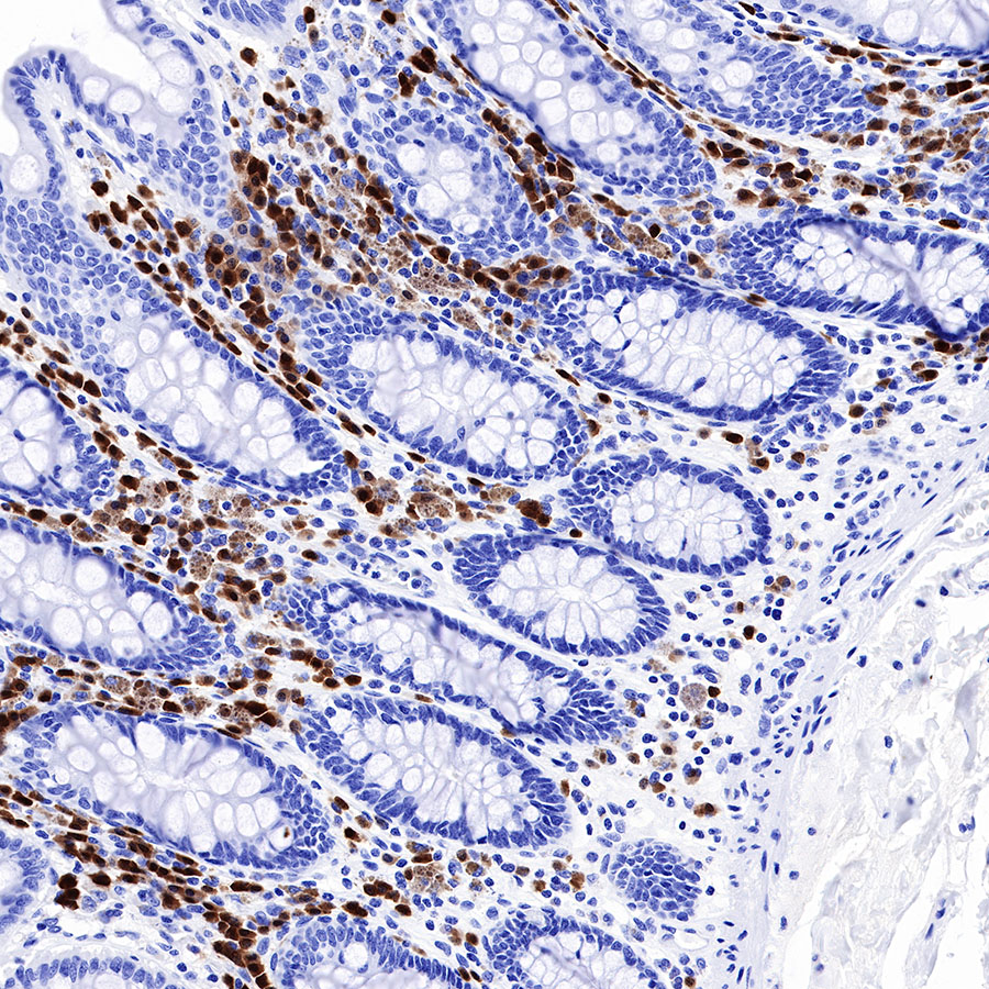 Rabbit anti-BOB-1 Recombinant Monoclonal Antibody(263-55)