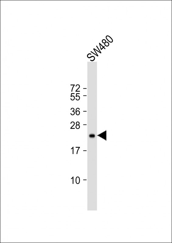 Mouse anti-TIMP2 Monoclonal Antibody(1554CT494.262.47)