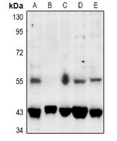 Rabbit anti-SGK1/2(pT256/253) Polyclonal Antibody