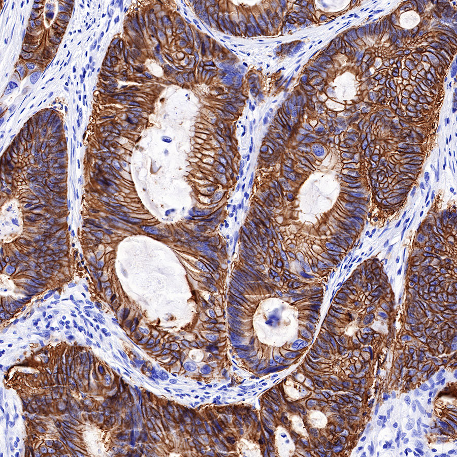 Rabbit anti-GPA33 Recombinant Monoclonal Antibody(248-76)