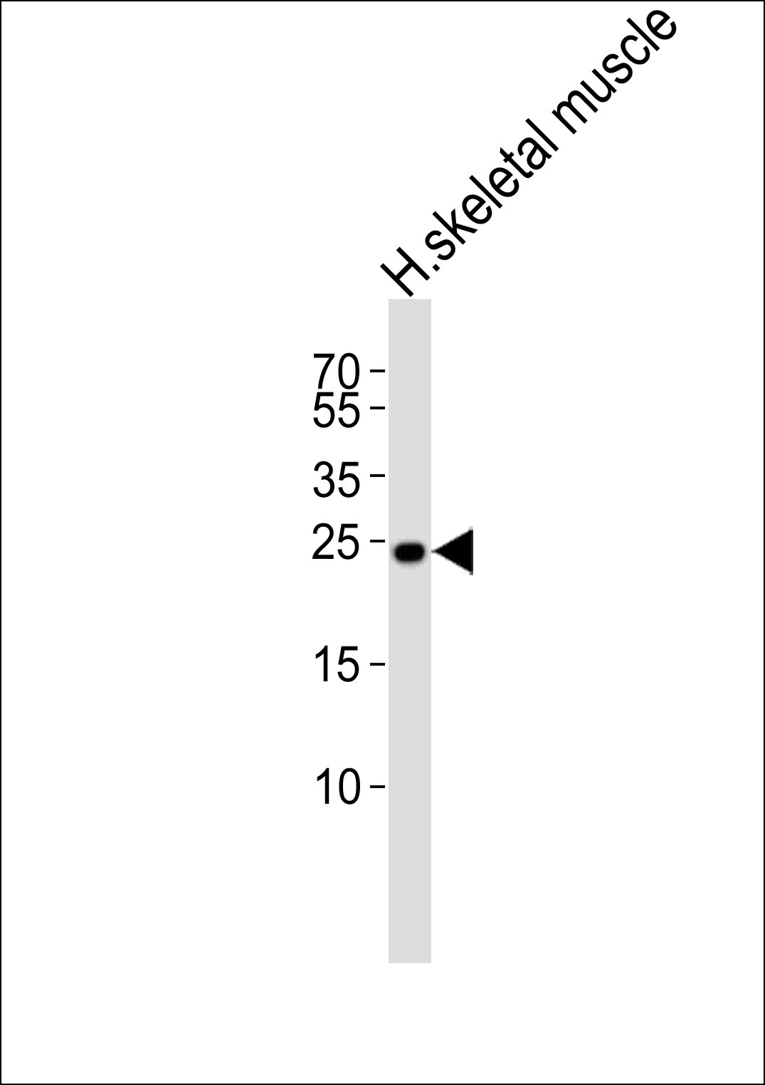 Rabbit anti-TMEM239 Polyclonal Antibody(N-term)