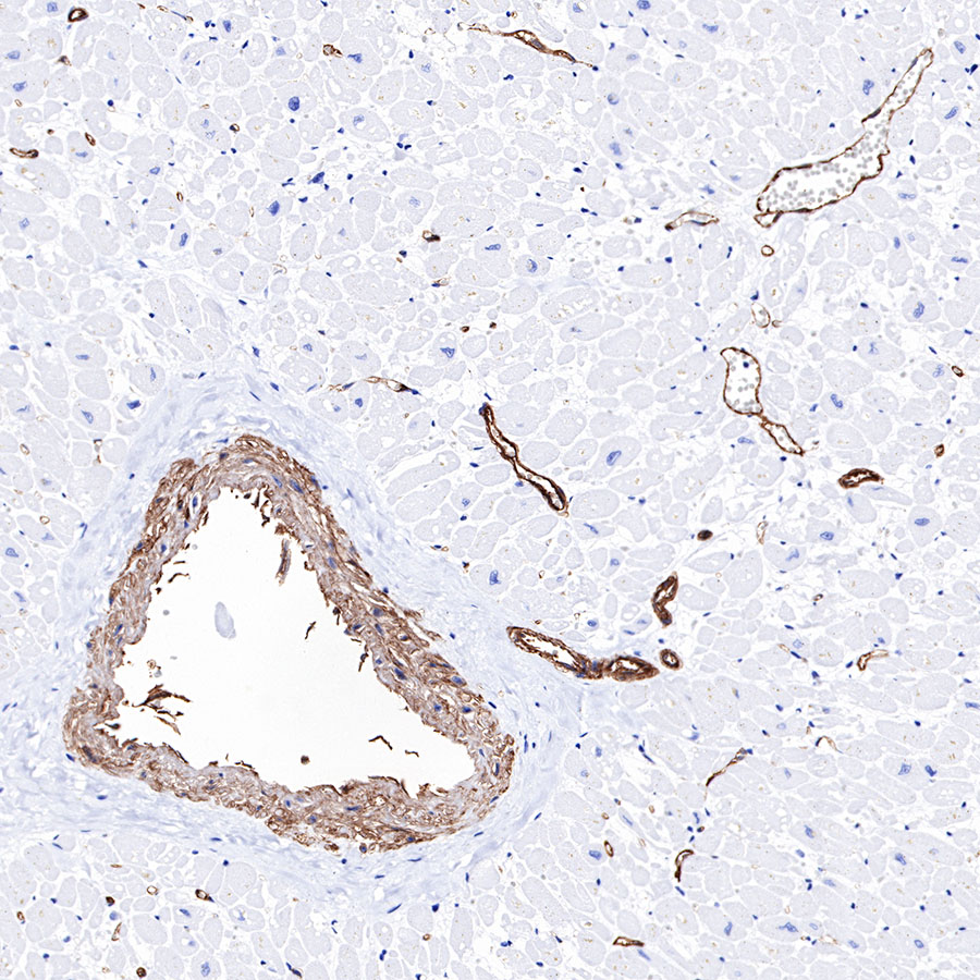 Rabbit anti-CD39 Recombinant Monoclonal Antibody(236-20)