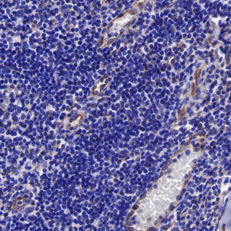 Rabbit anti-sFlt-1/VEGF Receptor 1 Recombinant Monoclonal Antibody(233-29)