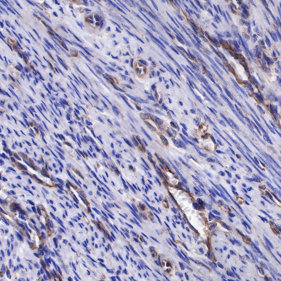 Rabbit anti-sFlt-1/VEGF Receptor 1 Recombinant Monoclonal Antibody(233-29)