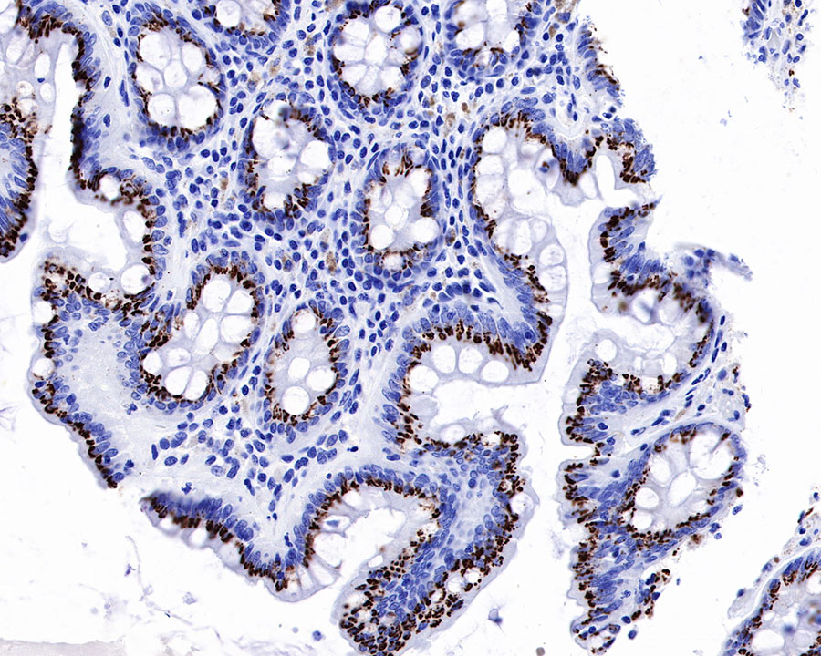 Rabbit anti-GP73/GOLPH2 Recombinant Monoclonal Antibody(231-102)